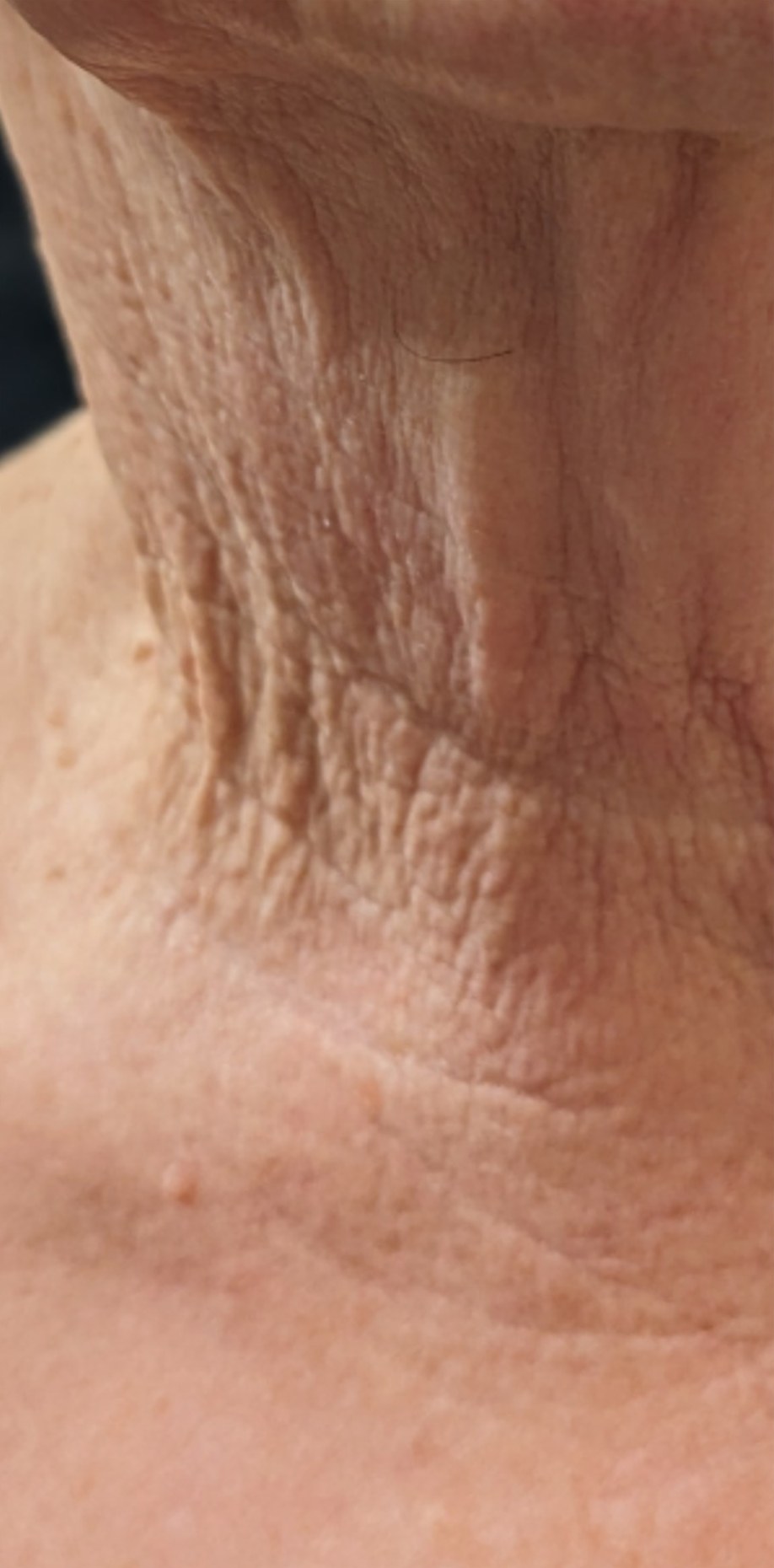 Forma · Neck, before photo